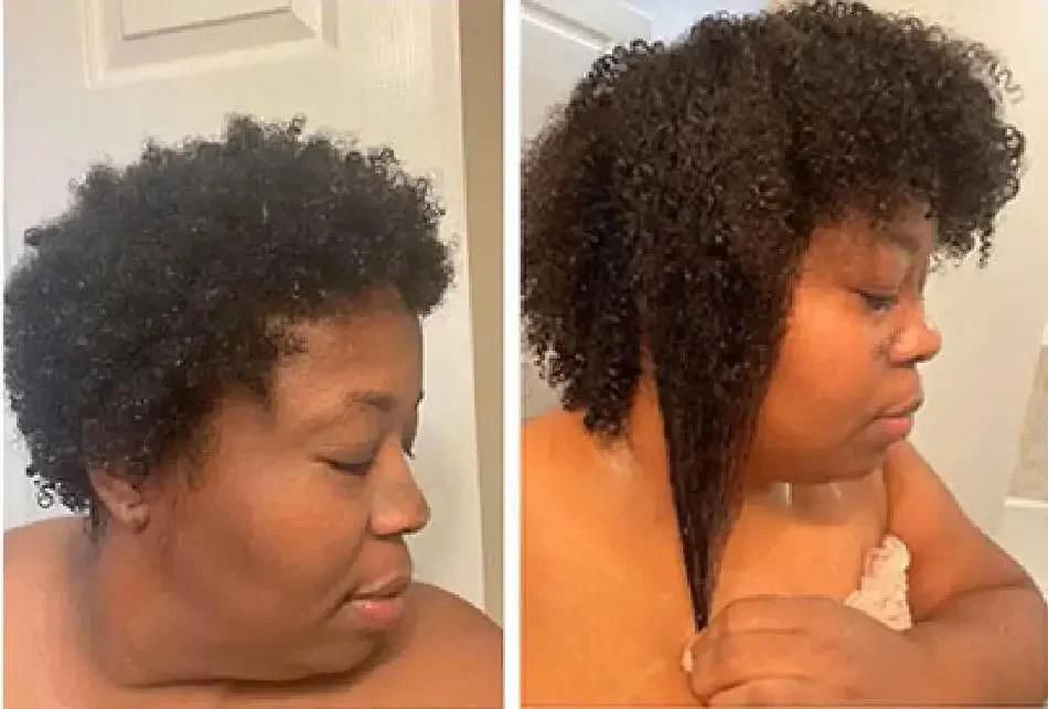 Rosemary hair growth